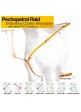Pechopetral Raid LR130035